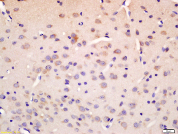 NCX1 Rabbit Polyclonal Antibody