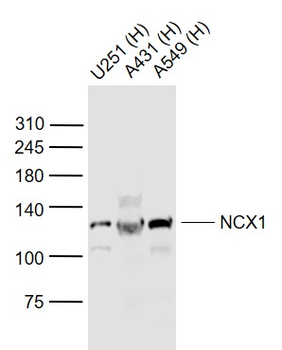 NCX1 Rabbit Polyclonal Antibody