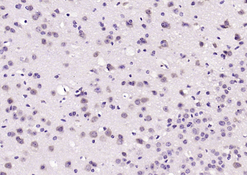 PAFAHG Rabbit Polyclonal Antibody