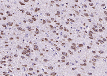 Neurocan Rabbit Polyclonal Antibody