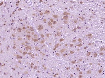 Neurocan Rabbit Polyclonal Antibody