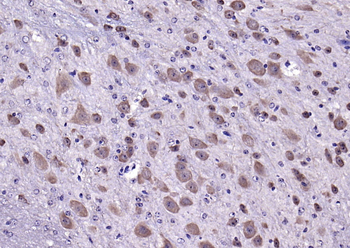 Neurocan Rabbit Polyclonal Antibody