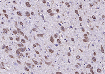 Neurocan Rabbit Polyclonal Antibody