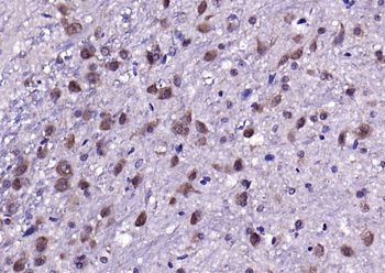 Neurocan Rabbit Polyclonal Antibody