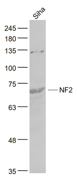 NF2 Rabbit Polyclonal Antibody