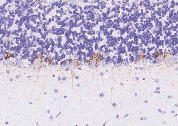 NF-H Rabbit Polyclonal Antibody