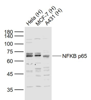 NFKB p65 Rabbit Polyclonal Antibody