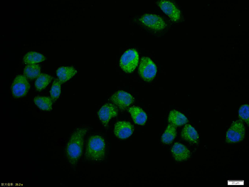 NFKB p65 Rabbit Polyclonal Antibody