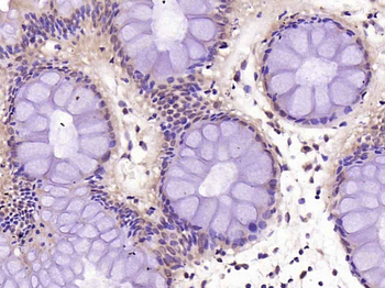 NFKB p65 Rabbit Polyclonal Antibody