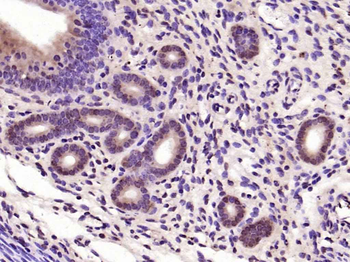 NFKB p65 Rabbit Polyclonal Antibody