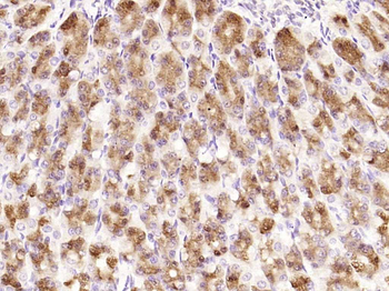 NFKB p65 Rabbit Polyclonal Antibody