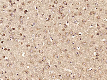 NF-M Rabbit Polyclonal Antibody