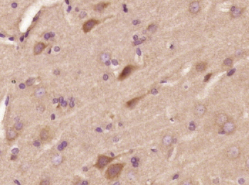 NF-M Rabbit Polyclonal Antibody