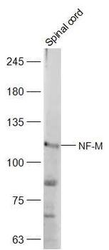 NF-M Rabbit Polyclonal Antibody