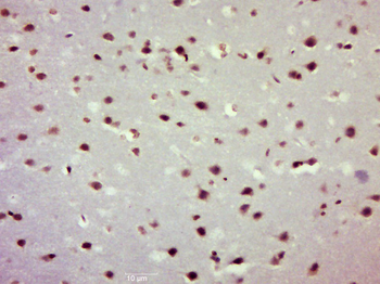 NFKB1 Rabbit Polyclonal Antibody