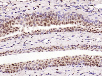 NFKB1 Rabbit Polyclonal Antibody