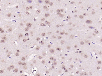 NFKB1 Rabbit Polyclonal Antibody