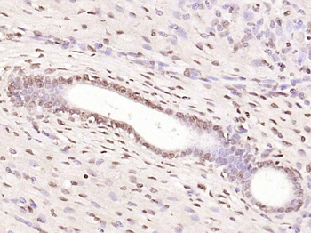 NFKB1 Rabbit Polyclonal Antibody