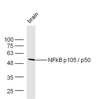 NFKB1 Rabbit Polyclonal Antibody