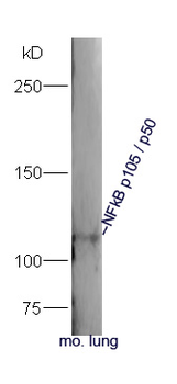 NFKB1 Rabbit Polyclonal Antibody
