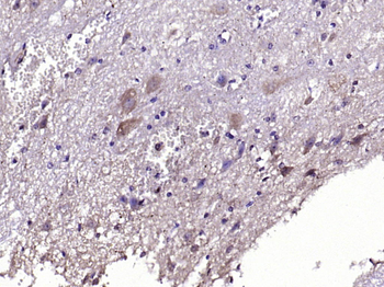 NKB Rabbit Polyclonal Antibody