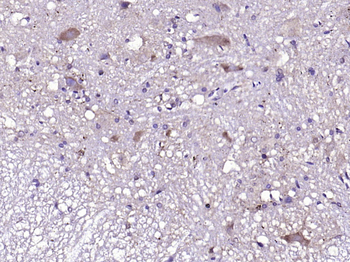 NKB Rabbit Polyclonal Antibody