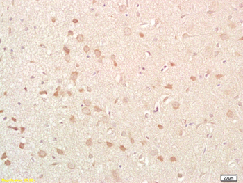 NKB Rabbit Polyclonal Antibody