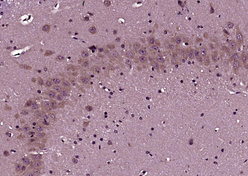 Neurokin B receptor Rabbit Polyclonal Antibody