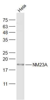 NME1/NM23A Rabbit Polyclonal Antibody