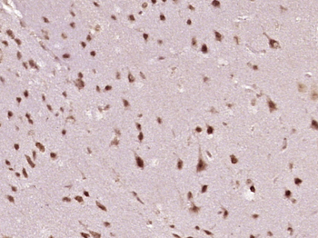 Nm23-H2/NME2 Rabbit Polyclonal Antibody