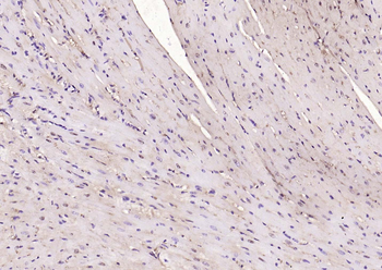 NADPH oxidase 4 Rabbit Polyclonal Antibody