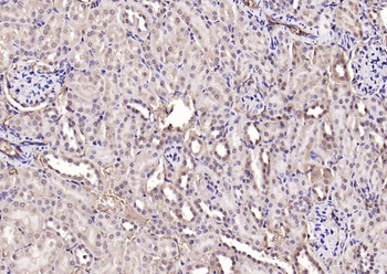 NADPH oxidase 4 Rabbit Polyclonal Antibody