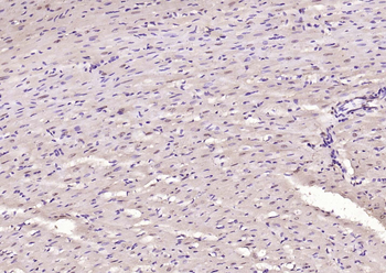 NADPH oxidase 4 Rabbit Polyclonal Antibody