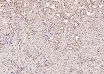 NADPH oxidase 4 Rabbit Polyclonal Antibody