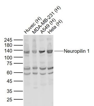 Neuropilin 1 Rabbit Polyclonal Antibody