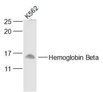 Hemoglobin Beta Rabbit Polyclonal Antibody