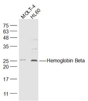 Hemoglobin Beta Rabbit Polyclonal Antibody