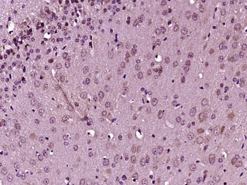 Neurotrophin 3 Rabbit Polyclonal Antibody
