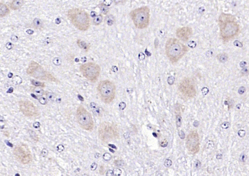 Neurotrophin 3 Rabbit Polyclonal Antibody