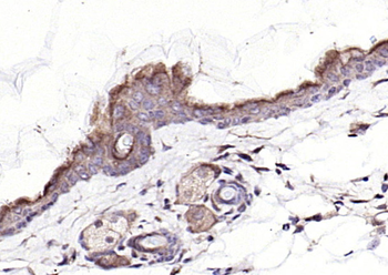 Neurotrophin 3 Rabbit Polyclonal Antibody