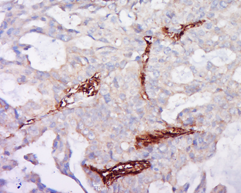 Neurotrophin 3 Rabbit Polyclonal Antibody