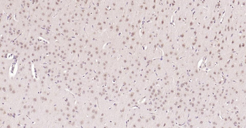 Nurr1 Rabbit Polyclonal Antibody
