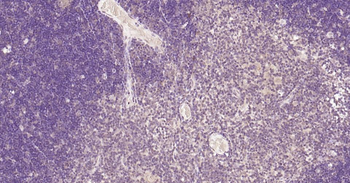 Nurr1 Rabbit Polyclonal Antibody