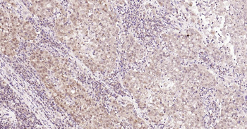 Nurr1 Rabbit Polyclonal Antibody