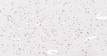 Nurr1 Rabbit Polyclonal Antibody