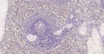 Nurr1 Rabbit Polyclonal Antibody