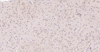 Nurr1 Rabbit Polyclonal Antibody