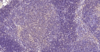 Nurr1 Rabbit Polyclonal Antibody