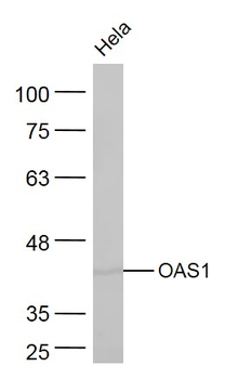 OAS1 Rabbit Polyclonal Antibody