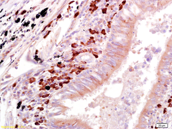 OAS1 Rabbit Polyclonal Antibody
